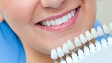 Tooth whitening guide